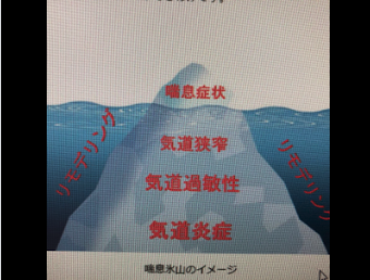 気管支喘息の病態