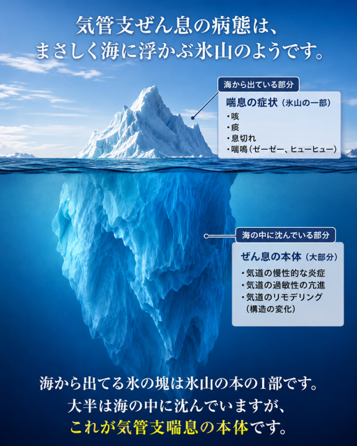 喘息の治療:発作は「氷山の一角」