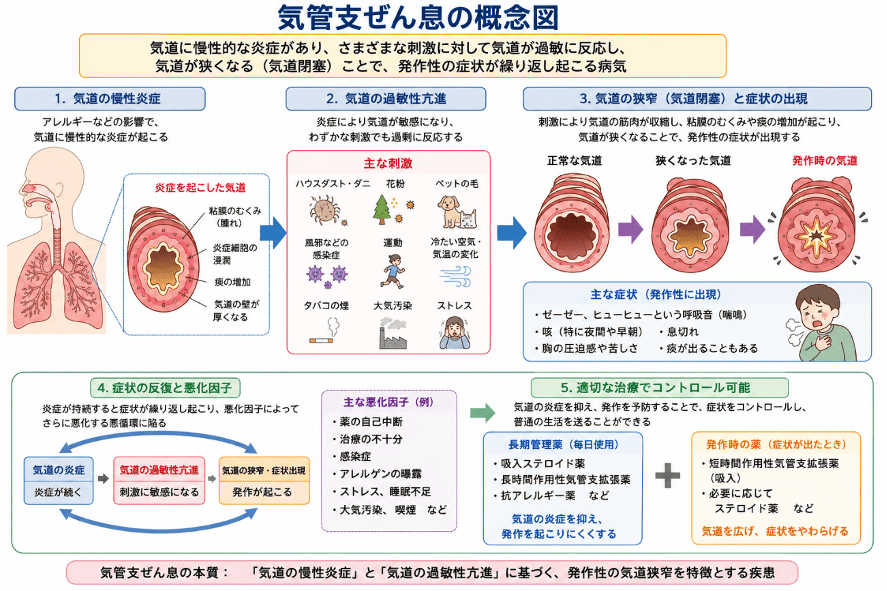 気管支ぜん息の概念図