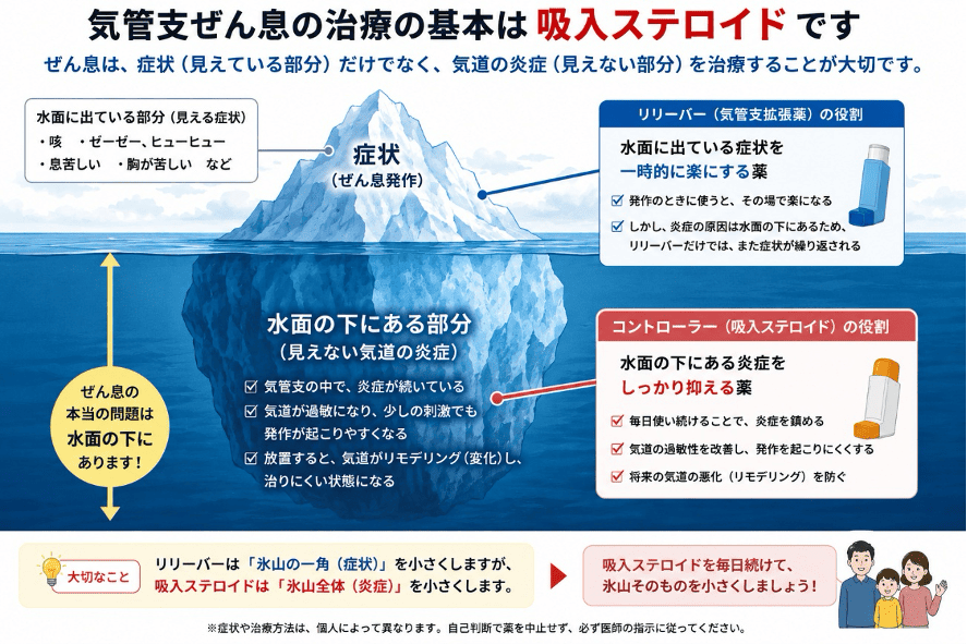 気管支ぜん息の治療の基本は吸収ステロイドです
